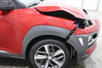 Hyundai Kona  picture 5