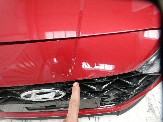 Hyundai I-20  picture 3